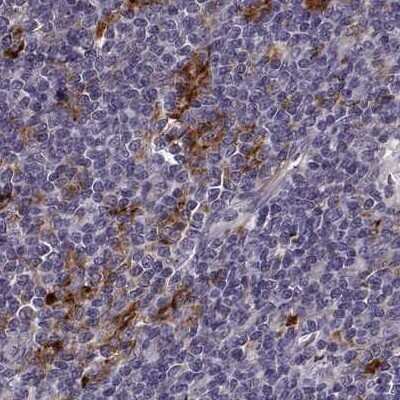 Immunohistochemistry-Paraffin: Cyclin F Antibody [NBP2-57569]