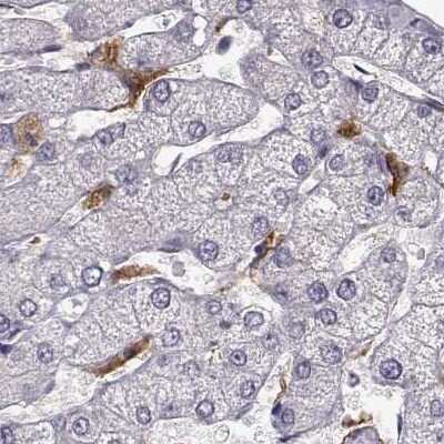 Immunohistochemistry-Paraffin: Cyclin F Antibody [NBP2-57569]