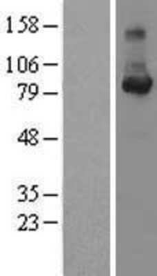 Western Blot: Cyclin F Overexpression Lysate [NBL1-08879]