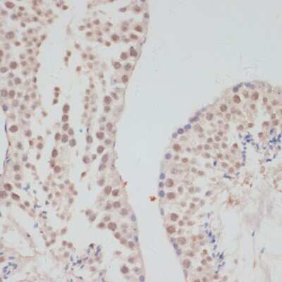 Immunohistochemistry-Paraffin: Cyclin G Antibody - BSA Free [NBP2-92649]
