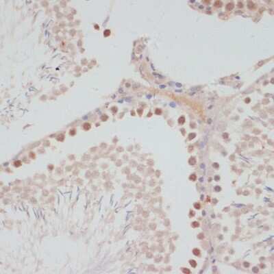Immunohistochemistry-Paraffin: Cyclin G Antibody - BSA Free [NBP2-92649]