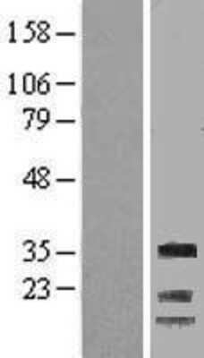 Western Blot: Cyclin G Overexpression Lysate [NBL1-08880]