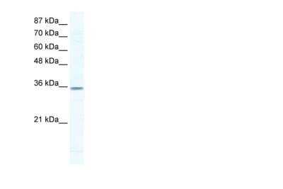 Western Blot: Cyclin G2 Antibody [NBP1-79935]