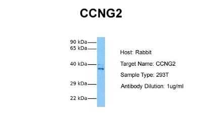 Western Blot: Cyclin G2 Antibody [NBP1-79935]