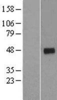 Western Blot: Cyclin G2 Overexpression Lysate [NBL1-08882]