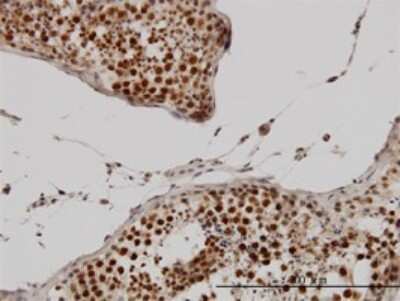 Immunohistochemistry-Paraffin: Cyclin H Antibody (1B8) [H00000902-M01]