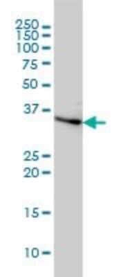 Western Blot: Cyclin H Antibody (1B8) [H00000902-M01]