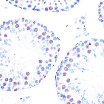 Immunohistochemistry-Paraffin: Cyclin H Antibody (3N5S3) [NBP3-16325]