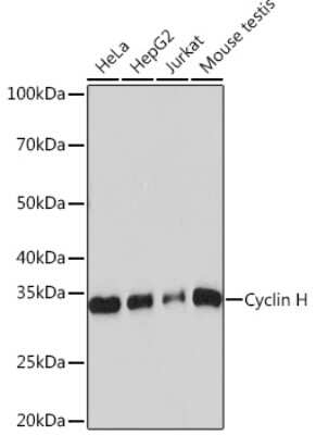 Western Blot: Cyclin H Antibody (3N5S3) [NBP3-16325]