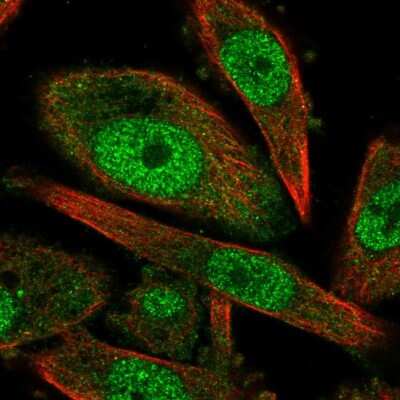 Immunocytochemistry/ Immunofluorescence: Cyclin H Antibody [NBP2-58123]