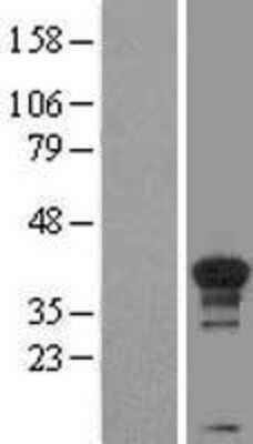 Western Blot: Cyclin H Overexpression Lysate [NBL1-08883]