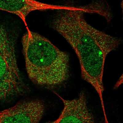 Immunocytochemistry/ Immunofluorescence: Cyclin I Antibody [NBP2-34060]