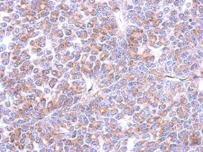 Immunohistochemistry-Paraffin: Cyclin I Antibody [NBP2-47123]