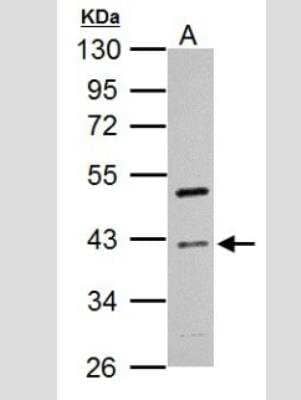 Western Blot: Cyclin I Antibody [NBP2-47123]