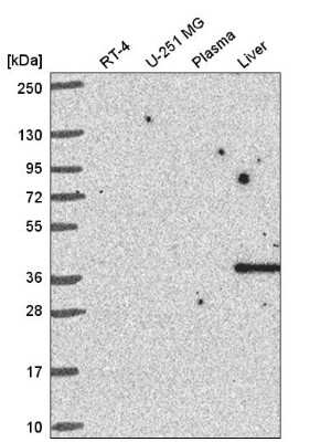 Western Blot: Cyclin I Antibody [NBP2-56916]