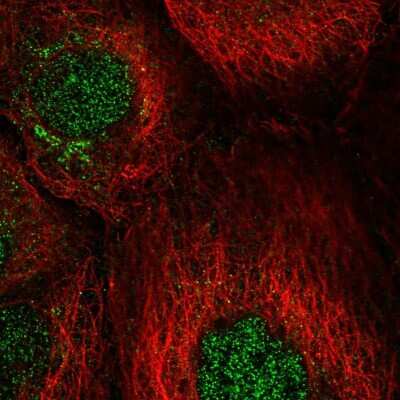 Immunocytochemistry/ Immunofluorescence: Cyclin J Antibody [NBP2-58810]