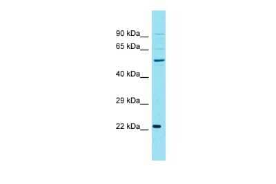 Western Blot: Cyclin J Antibody [NBP3-10728]