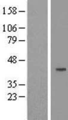 Western Blot: Cyclin J Overexpression Lysate [NBL1-08885]