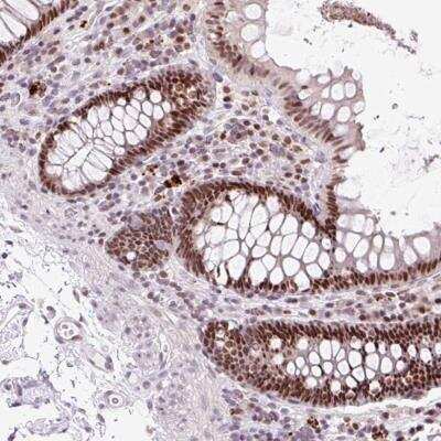 Immunohistochemistry-Paraffin: Cyclin L2 Antibody [NBP2-47497]