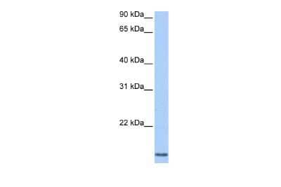 Western Blot: Cyclin L2 Antibody [NBP2-84745]