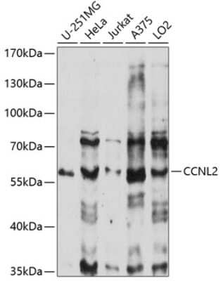 Western Blot: Cyclin L2 AntibodyAzide and BSA Free [NBP2-92197]