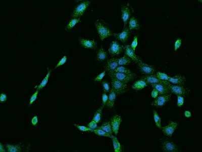 Immunocytochemistry/ Immunofluorescence: Cyclin M3 Antibody [NBP2-97251]