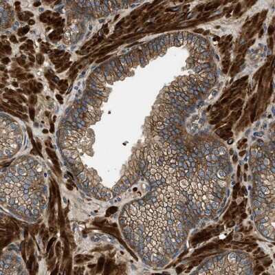 Immunohistochemistry-Paraffin: Cyclin M3 Antibody [NBP1-90272]