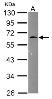 Western Blot: Cyclin M3 Antibody [NBP2-16057]