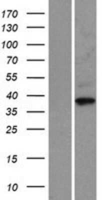 Western Blot: Cyclin-O Overexpression Lysate [NBP2-06557]