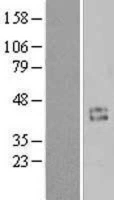 Western Blot: Cyclin I Overexpression Lysate [NBL1-08884]