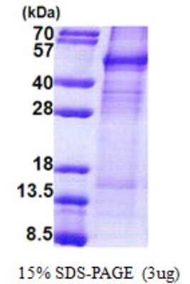 SDS-PAGE: Recombinant Human Cyclin I His Protein [NBP2-22970]