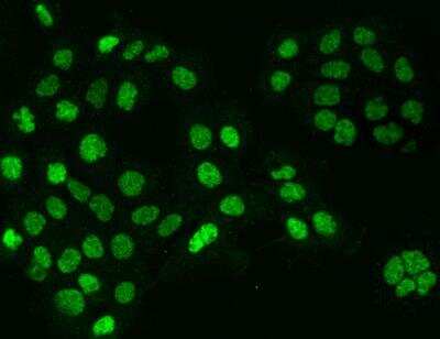 Immunocytochemistry/ Immunofluorescence: Cyclin T1 Antibody [NBP3-06557]