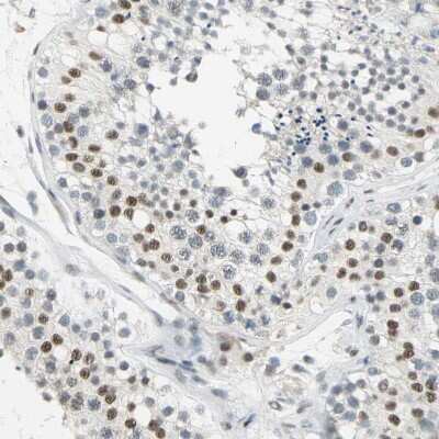 Immunohistochemistry-Paraffin: Cyclin T1 Antibody [NBP3-05509]