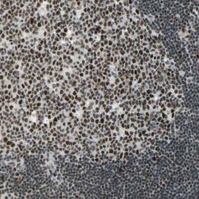 Immunohistochemistry-Paraffin: Cyclin T1 Antibody [NBP3-05509]