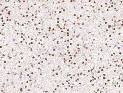 Immunohistochemistry-Paraffin: Cyclin T1 Antibody [NBP3-06557]