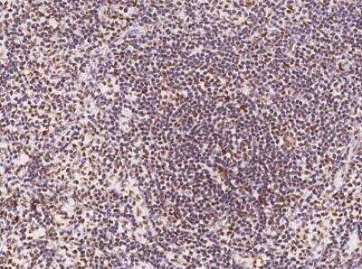 Immunohistochemistry-Paraffin: Cyclin T1 Antibody [NBP3-06557]
