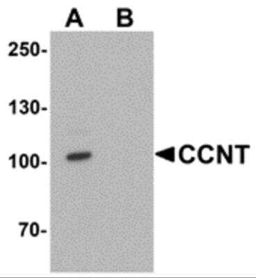 Western Blot: Cyclin T1 AntibodyBSA Free [NBP2-81898]