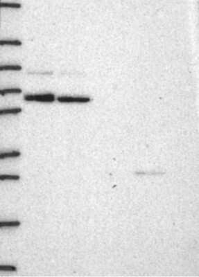 Western Blot: Cyclin T1 Antibody [NBP3-17238]