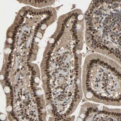Immunohistochemistry-Paraffin: Cyclin T2 Antibody [NBP1-87592]