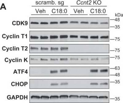 Knockout Validated: Cyclin T2 Antibody [NBP1-87592]