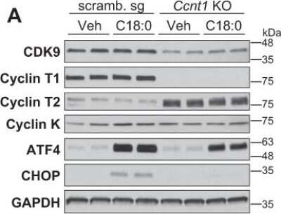 Western Blot: Cyclin T2 Antibody [NBP1-87592]