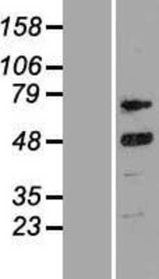 Western Blot: Cyclin T2 Overexpression Lysate [NBP2-10962]