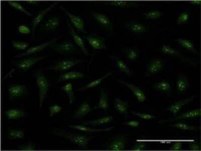 Immunocytochemistry/ Immunofluorescence: Cyclophilin 40 Antibody (4C7) [H00005481-M01]