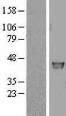 Western Blot: Cyclophilin 40 Overexpression Lysate [NBL1-14648]