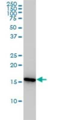 Western Blot: Cyclophilin A Antibody (1F4-1B5) [H00005478-M01]