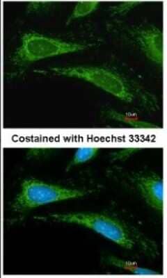 Immunocytochemistry/ Immunofluorescence: Cyclophilin A Antibody [NBP1-30993]
