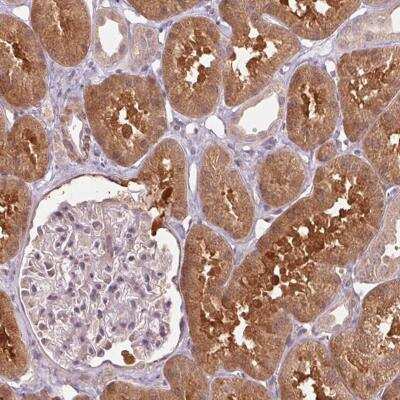 Immunohistochemistry: Cyclophilin A Antibody [NBP2-46850]