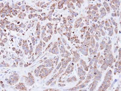Immunohistochemistry-Paraffin: Cyclophilin A Antibody [NBP1-30993]