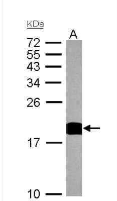 Western Blot: Cyclophilin A Antibody [NBP1-30993]