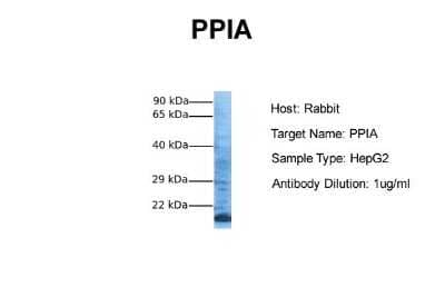 Western Blot: Cyclophilin A Antibody [NBP1-54388]